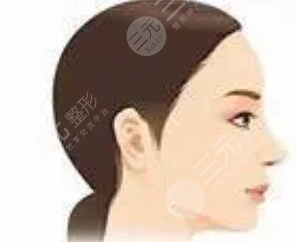 3度仿生美鼻+彩光祛雀斑+多维立体丰下颏前后对比果图片