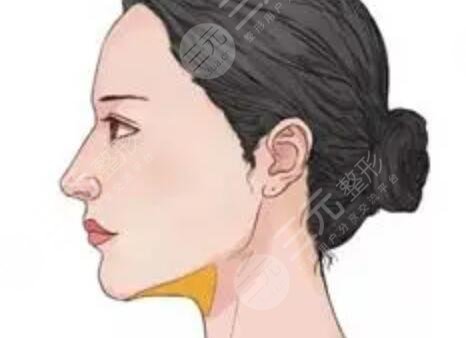 3度仿生美鼻+彩光祛雀斑+多维立体丰下颏前后对比果图片