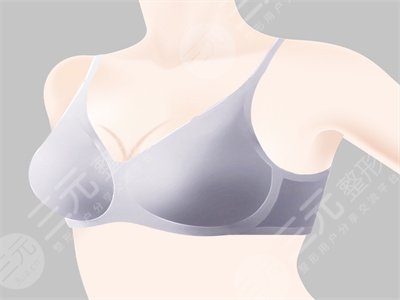 假体隆胸果自然吗 225cc假体植入案例分享