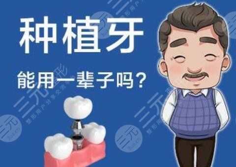 种植牙能用多少年