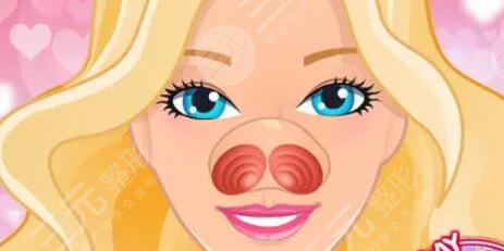 长沙美研孔伟立医生怎么样?综合隆鼻手术案例分享~