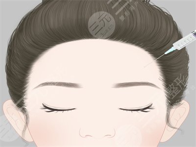 玻尿酸丰太阳穴和自体脂肪填充太阳穴果都不错