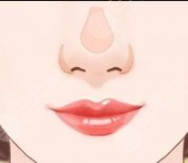 广州李高峰医生综合隆鼻案例分享,还有前后对比果照片~ 广州李高峰医生综合隆鼻案例分享,还有前后对比果照片~