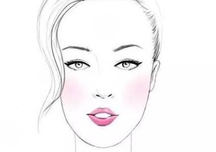 杭州格莱美双眼皮案例