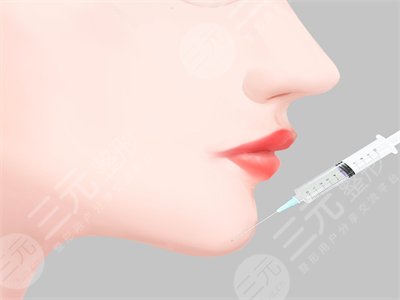 假体垫下巴12天恢复图