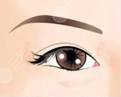 杨维琦双眼皮修复案例：术前眼睛失败没自信，60天后，双眼再获美丽！