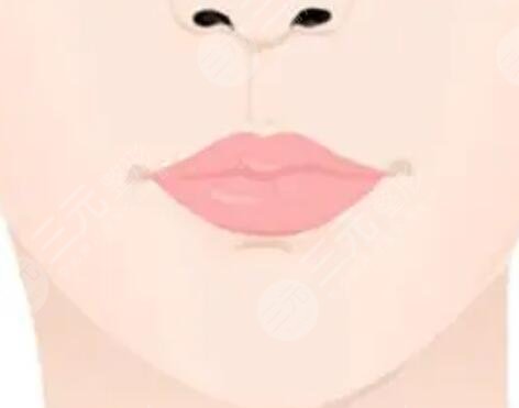 嘟嘟唇打完5天内的图片