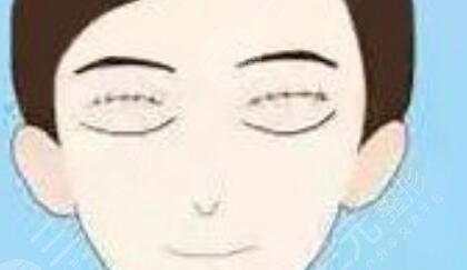 脸部凹陷做脸部脂肪填充好吗？多少钱？真人案例多对比照片