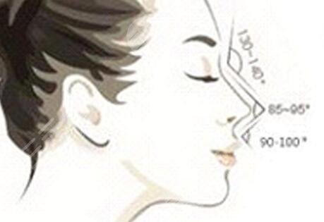 鼻头鼻翼缩小+假体隆鼻对比图片案例