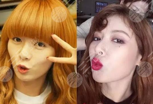 金泫雅否认整容却不提丰唇其实除了嘴巴她还动过这些地方