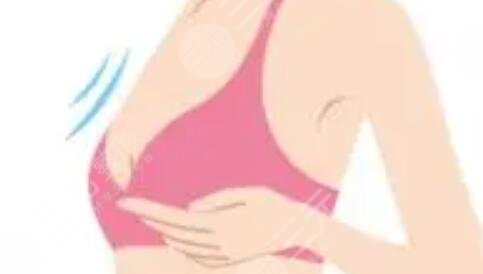 360度吸脂瘦腰腹