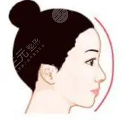 九院韦敏做的鼻子自然吗?看一下隆鼻案例就清楚了~