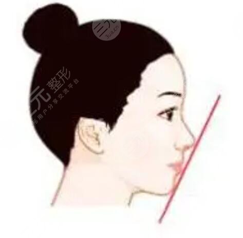 九院韦敏做的鼻子自然吗?看一下隆鼻案例就清楚了~
