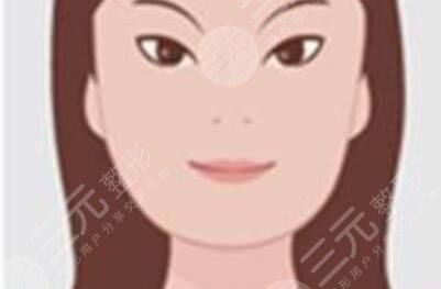 张寒下颌角整容案例：轻松获得小V脸一枚~