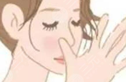 上海九院谢峰隆鼻案例，感觉换了个人更美了~