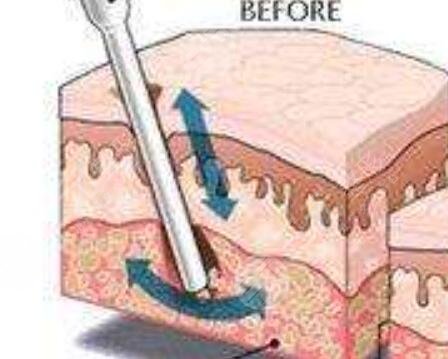 成都铜雀台的教你如何瘦手臂【日记】