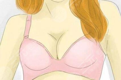 自体脂肪丰胸果对比|武侯黄氏百佳整形反馈