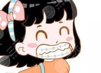 成都高新圣贝牙齿矫正贵不贵？附矫正案例过程分享