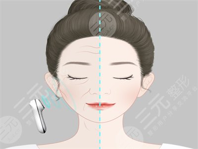 成都医美整形医院怎么样?附面b提升变美日记