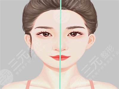 面部轮廓整形