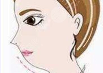 肋骨鼻恢复过程图片欣赏，来看看过来人的心路历程~