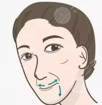 福州海峡整形果好不好？隆隆鼻整形日记诚意分享