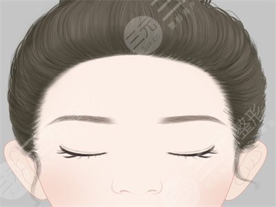 厦门思明海峡整形口碑好不好?丰太阳穴术后对比分享