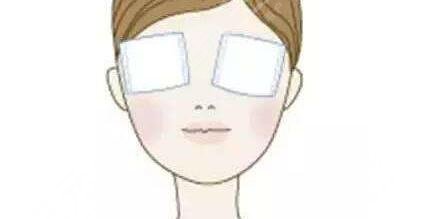 温州附二医徐海艇双眼皮手术费用是多少？分享我的双眼皮案例~