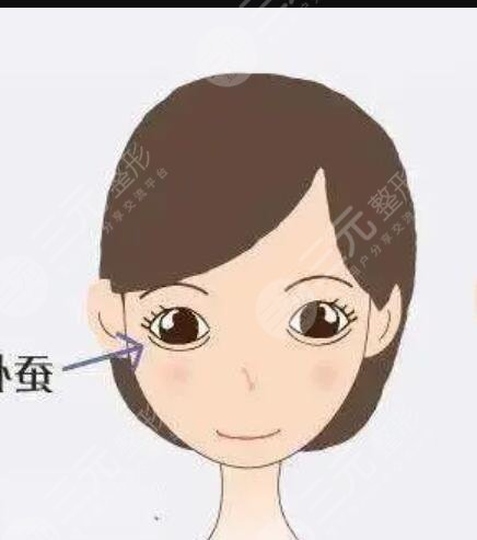 上海光博士医疗美容门诊部微创祛眼袋怎么样?祛眼袋案例分享