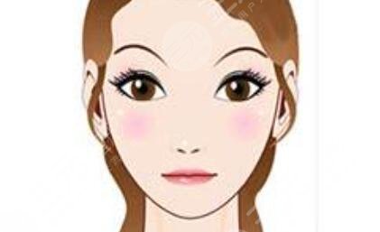 八大处杨斌垫下巴案例分享，术后2个月自述，感觉性价比蛮高的~