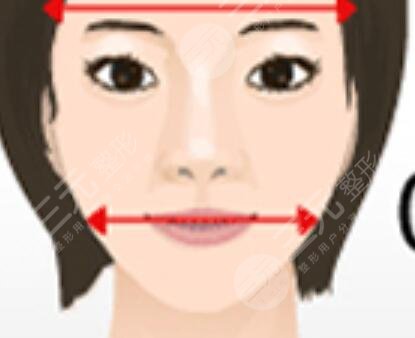 2020北京八大处削骨价格表丨削骨案例分享，告别难看的大饼脸~