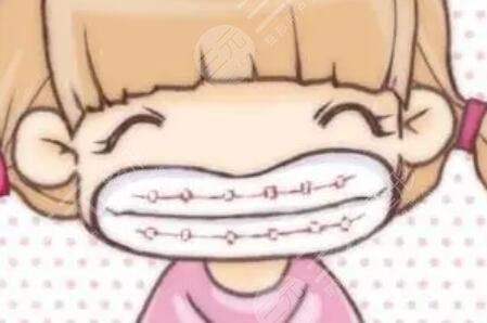 地包天矫正前后对比照片