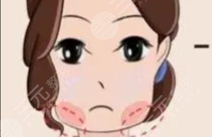 打注射瘦脸前后对比照片真实果图