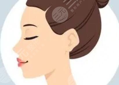 丽星整形魏医生怎么样