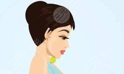 丽星整形魏医生假体隆鼻案例术前