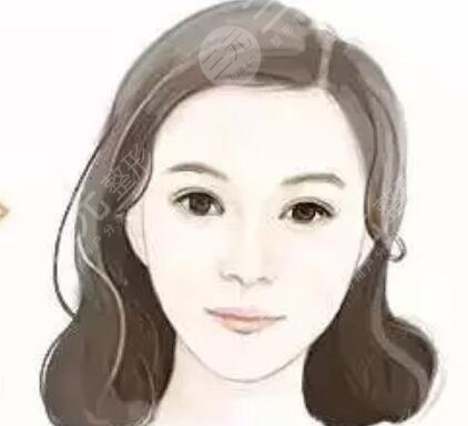 垫下巴案例 假体垫下巴恢复过程分享