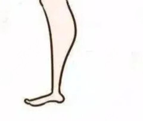 吸脂减肥真人案例 大腿吸脂亲身经历