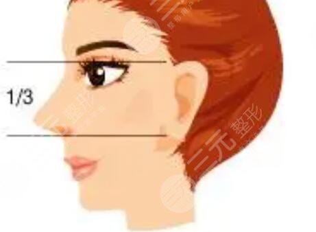 隆鼻整形术后案例 隆鼻整形真实案例