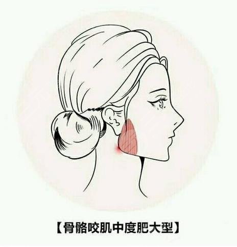 黄大勇磨骨后4天