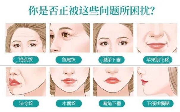 多大年龄适合做拉皮手术?