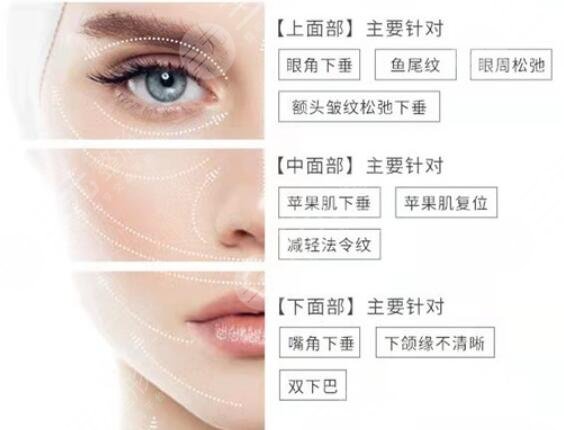 拉皮手术的优势有什么?