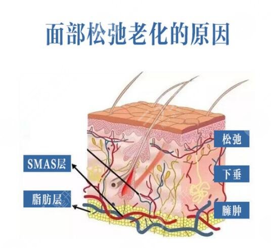 拉皮手术术前注意事项
