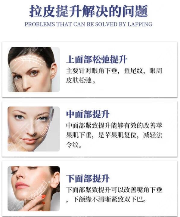 拉皮除皱术结果
