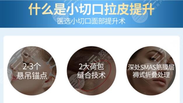 拉皮手术需要多少钱?