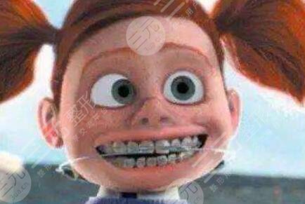 南通口腔医院整牙案例