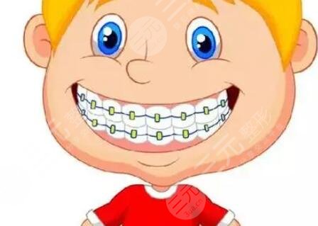 牙齿矫正案例