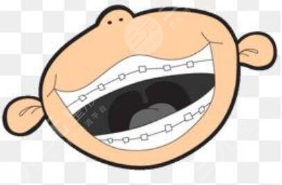 骨性牙性龅牙矫正