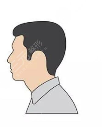 广州中山一院植发挂什么科