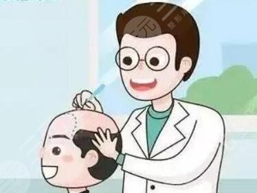 广州南方医院植发贵吗