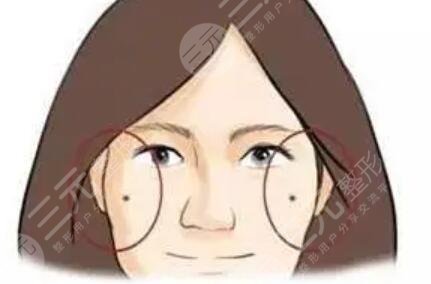邯郸第三医院美容激光科价格表,附祛痣案例